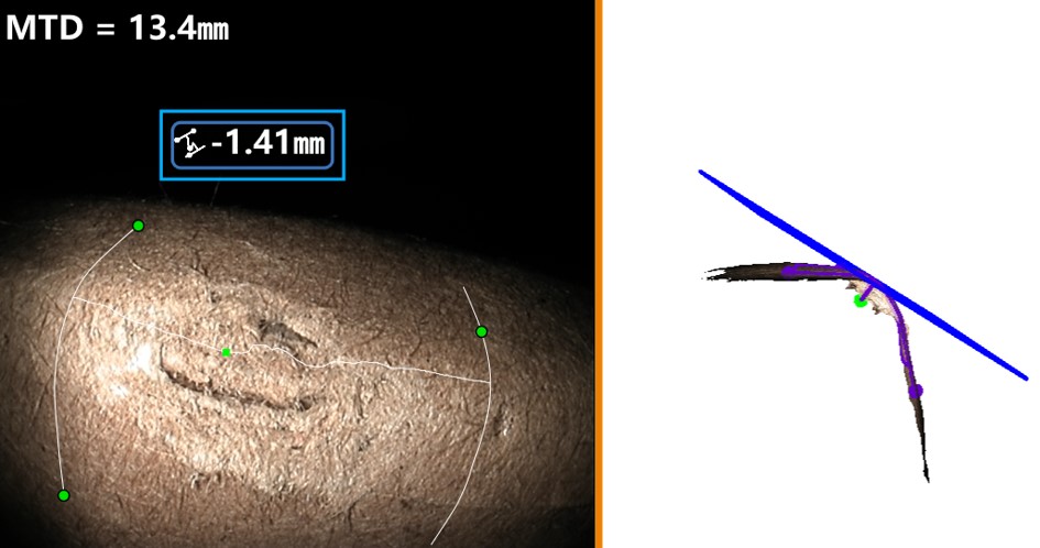 案例2:測量渦輪葉片前緣弧面凹坑